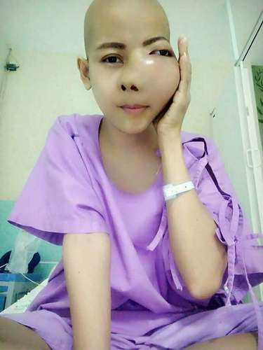 泰国美女患骨癌 脸部严重错位如同ps