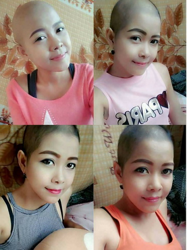 泰国美女患骨癌 脸部严重错位如同ps